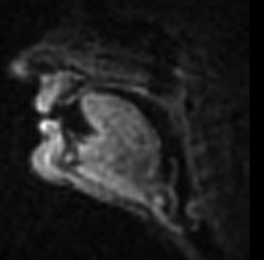 MRI videos of people pronouncing R